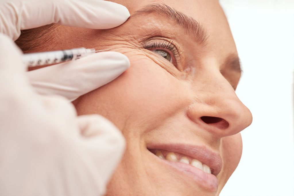 A woman receiving precise injections in her crow's feet area at Revive and Drip, highlighting the detailed care involved in aesthetic treatments. This procedure is part of the comprehensive range of services offered by Revive and Drip, including Botox injections, dermal fillers, IV therapy, and weight loss treatments. The clinic focuses on enhancing natural beauty while providing professional, medically supervised treatments to help clients achieve their wellness and aesthetic goals.